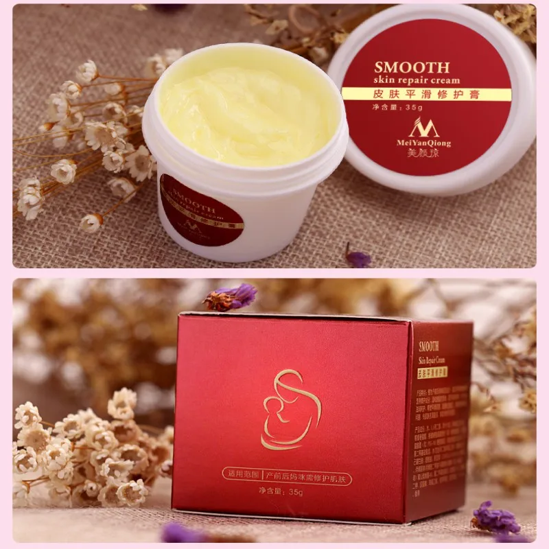 Repair Body Cream Removal To Maternity Skin Smooth Skin Cream Remove Stretch Marks Scar