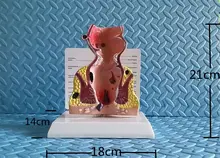 

The pathological rectum model crissum Anorectal anatomy model