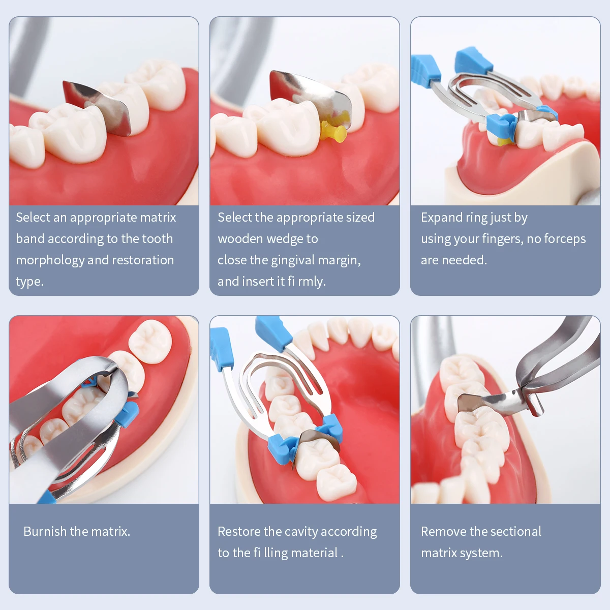 AZDENT Dental Matrix Schnitts Konturierte Matrizen Schellen Keile Metall  Frühling Clip Ringe Zahnarzt Werkzeuge Dental Lab Instrument