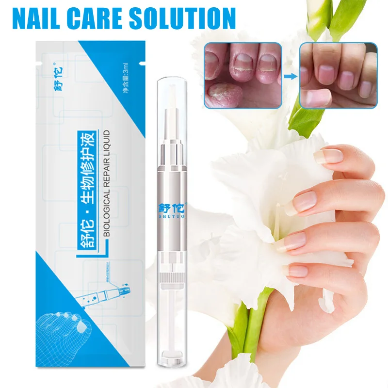  3ml Nail Fungus Treatment Liquid Anti Fungal Finger Toe Nail care solution Professional Herb Nails 