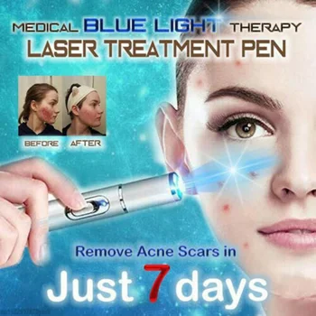 

Hot Heath Blue Light Therapy Varicose Veins Treatment Laser Pen Soft Scar Wrinkle Removal Treatment Acne Laser Pen Massage Relax