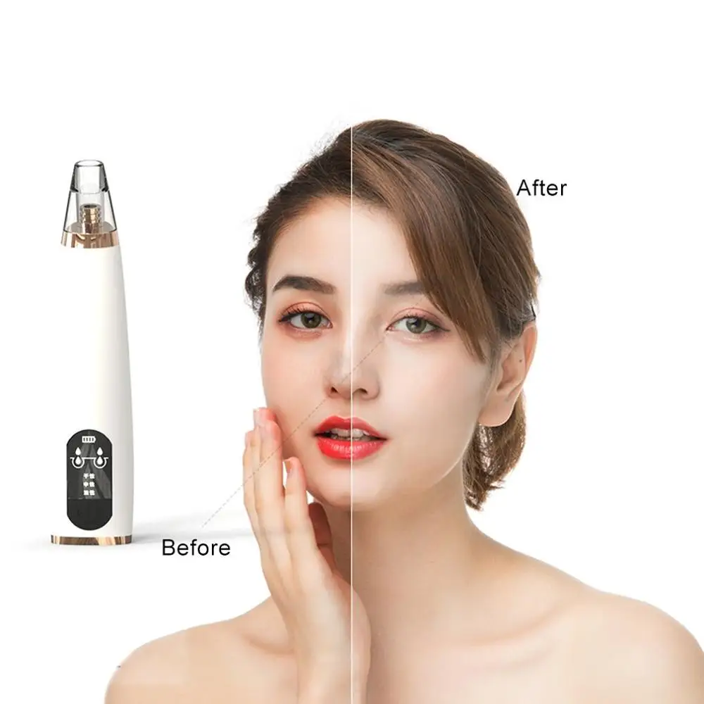 

Vacuum Suction Blackhead Remover Nose Facial Pore Spot Cleaner Acne Black Head Pimple Remover Beauty instrument Skin Care Tool