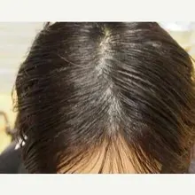 Productos para la pérdida de cabello, Productos naturales sin efectos secundarios para el crecimiento rápido del cabello y el rejuvenecimiento del cabello