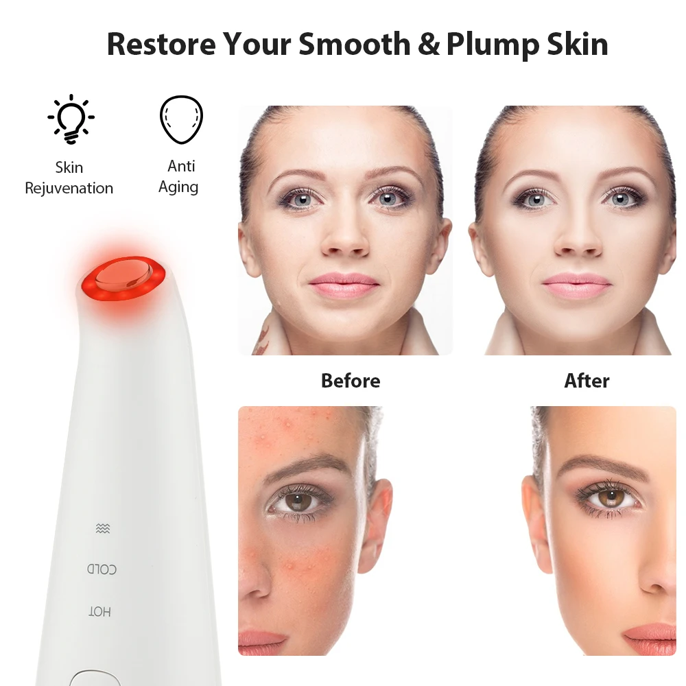 LED Photon Therapy Facial Massage Sonic Vibration Hot Cool Wrinkle Remover  Anti Aging Treatment Skin Care Face Beauty Device - AliExpress Beauty &  Health
