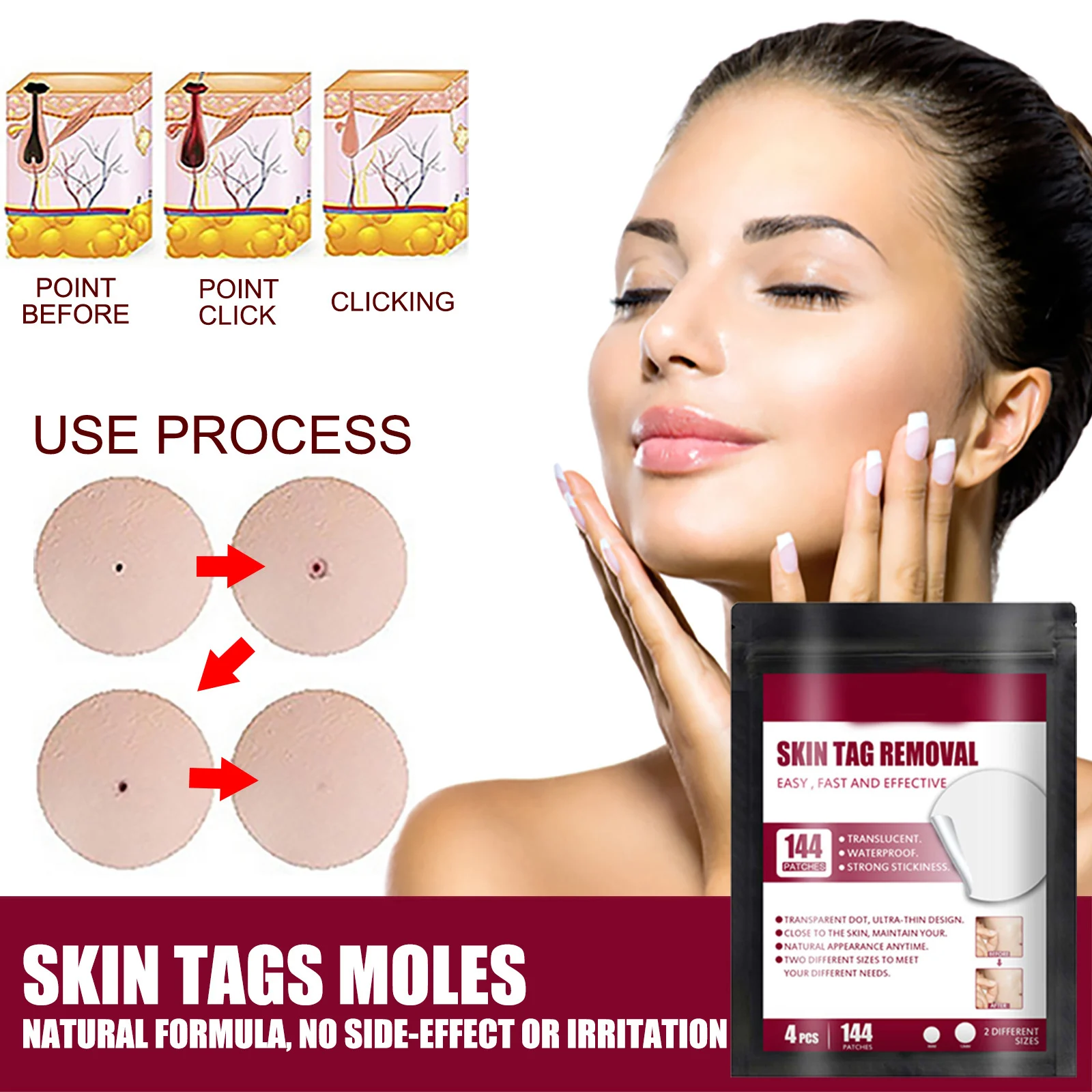 Instant Spot Removal Gel Skin Tag Removal Patches Wart Removal Body