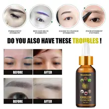 30ml Tattoo Removal Treatment Functional Plant Extracts Natural for Unisex Tattoo Cleaning Liquid Tattoo Removal Liquid