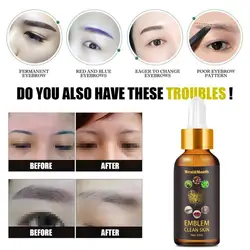 30ml Tattoo Removal Treatment Functional Plant Extracts Natural for Unisex Tattoo Cleaning Liquid Tattoo Removal Liquid