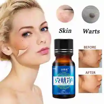 

Effective Skin Tag Remover Pen Skin Repair liquid Medical Kill Remover Foot Corn Skin Tag Mole & Genital Liquid Wart Remover