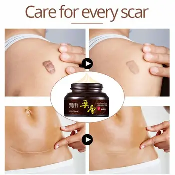 

Hot Sell 2019 Plant Extract Repair Smoothing Cream Scar Face Surgical Repair Burn Cream Repair Cream Scar Skin R7M4