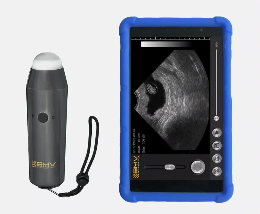 

The Versatile ultrasound for pig-sheep-goat animal scanning scanner farmscan wireless probe POCKET