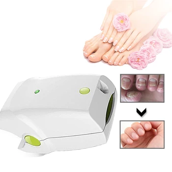 

Effective Nail Cleaning Machine 905nm Nail Fungus Laser for Onychomycosis
