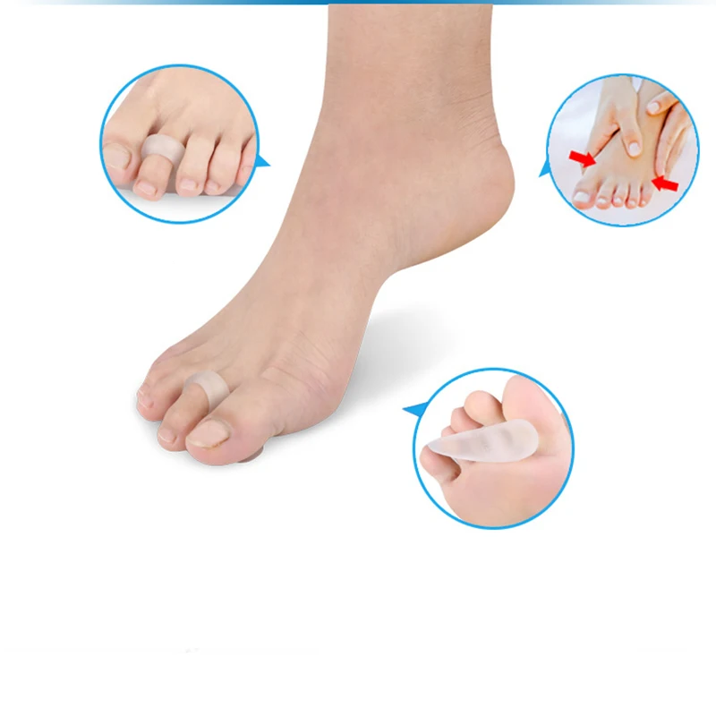 1Pair Gel Silicone Foot Corrector Tool Metatarsal Toe Gel Pad Forefoot Foot Pads Hallux Valgus Corrector 1
