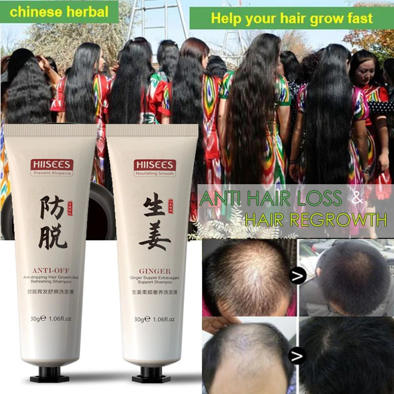 Hair Growth Shampoo Anti Hair Loss Conditioner for Men/Women Hair Regrowth  Treatment Make Hair Stronger/Thicker Care Products|Hair Loss Products| -  AliExpress