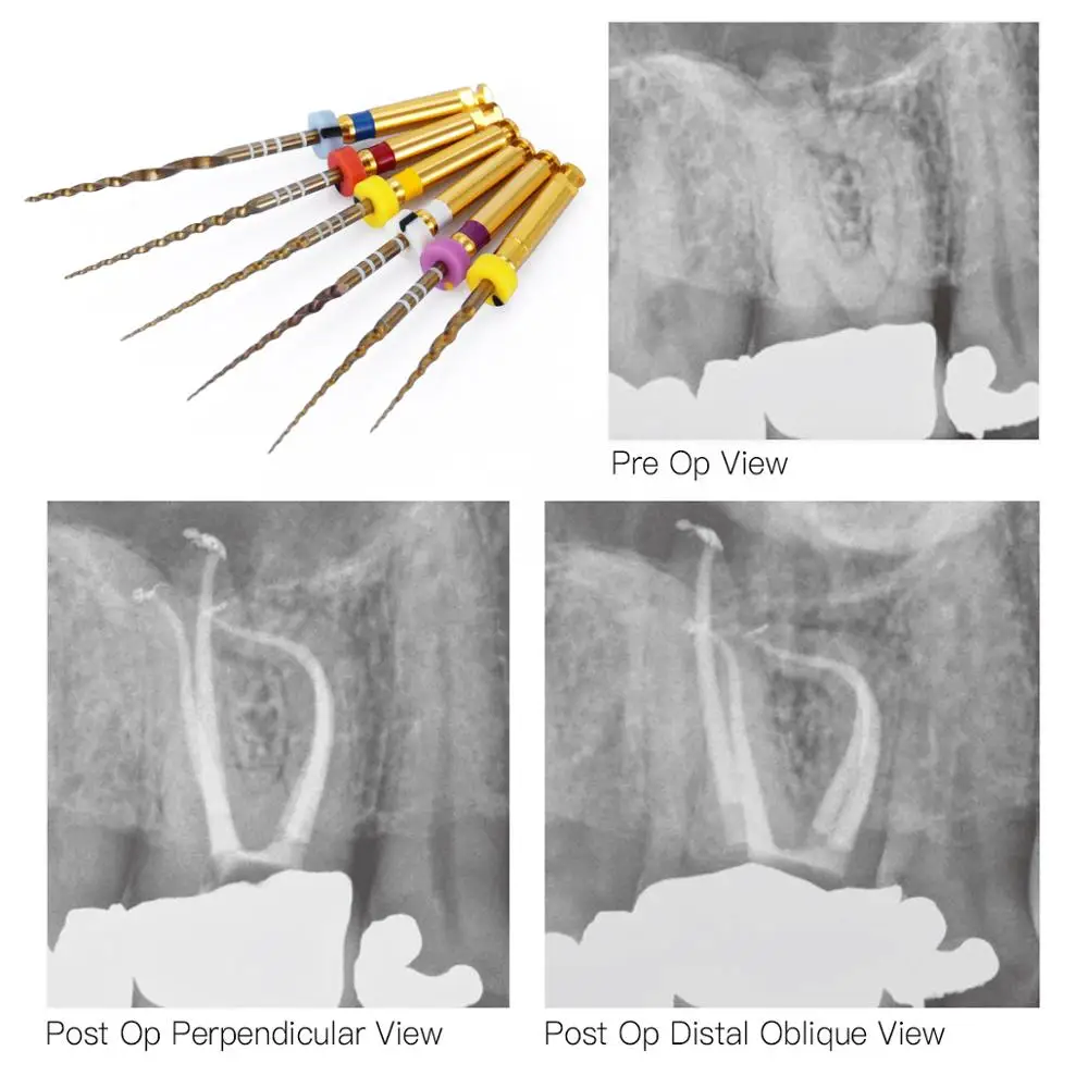AZDENT роторный супер канал корень золотые файлы Стоматологическая лаборатория NITI Endodontic Pro супы медицинская клиника стоматолога двигатель использовать SX-F3 25 мм