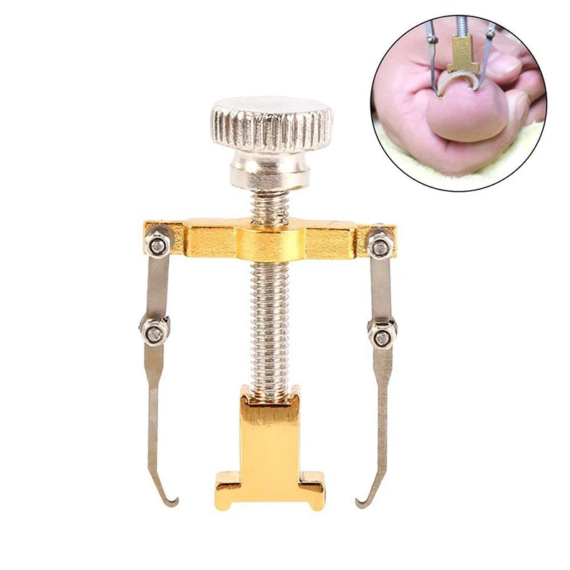 Ingrown Toenails Pedicure Foot Nail Care Tools File for Feet Orthotic Acronyx Bunion Corrector Toes Hot Sale | Красота и здоровье