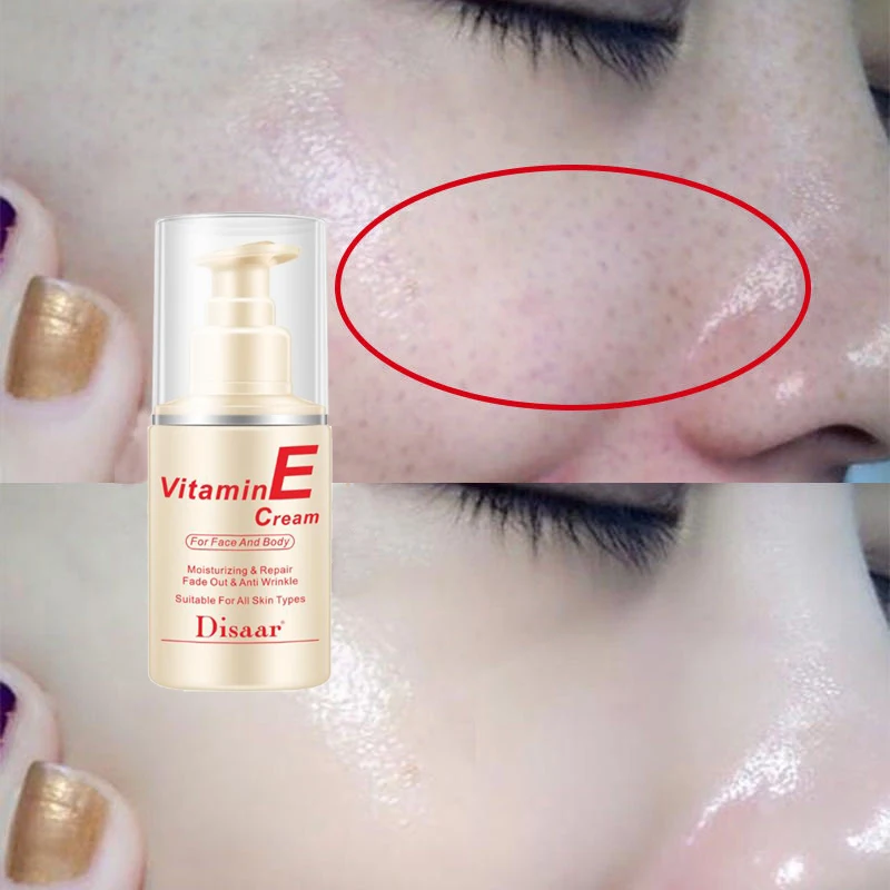 whitening body cream vitamin e