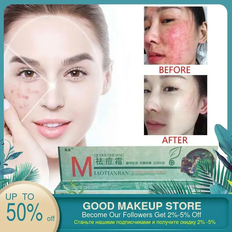 1pcs Original Fuyou Miaotianran Remove Acne Cream Germicidal Remove