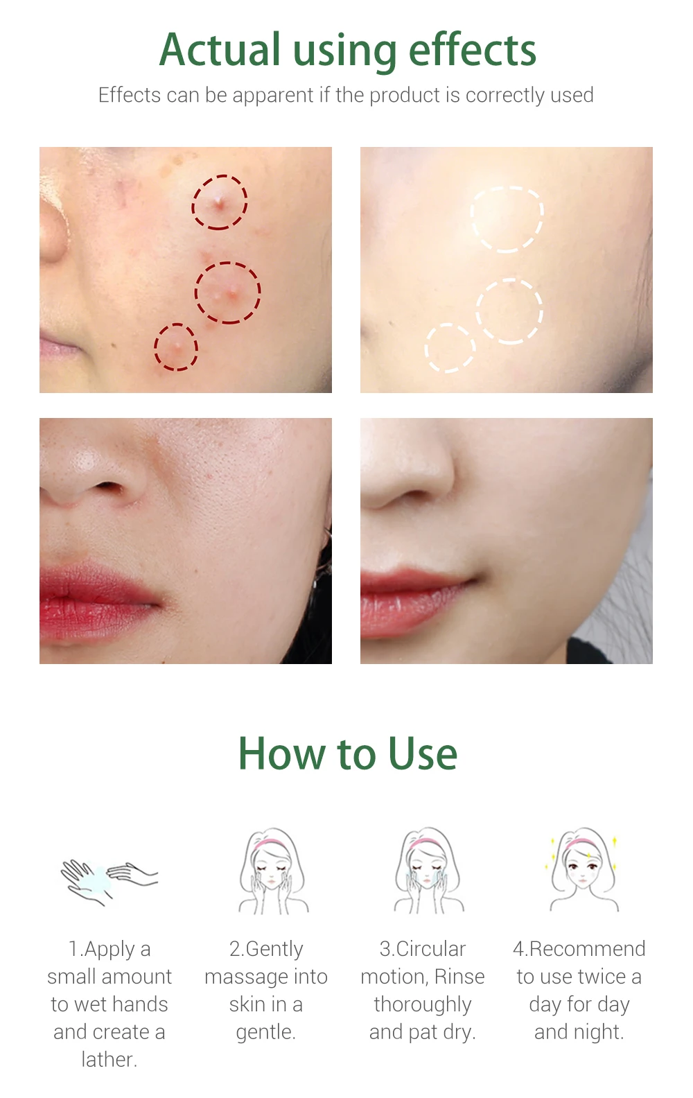 BREYLEE-茶树祛痘洁面乳（英文）_08