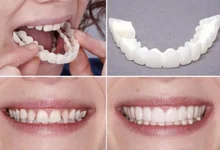 

1 Set Teeth Veneer Whitening Snap On Smile Teeth Cosmetic Denture Instant Perfect Smile Teeth Fake Tooth Cover Oral Hygiene Tool