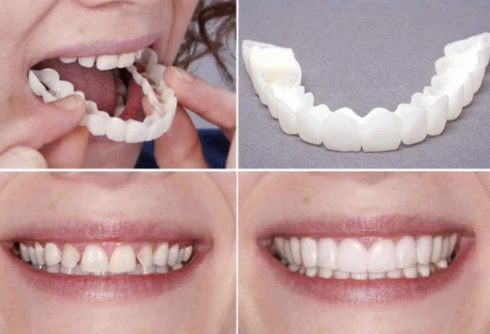 1 Set Teeth Veneer Whitening Snap On Smile Teeth Cosmetic Denture Instant  Perfect Smile Teeth Fake Tooth Cover Oral Hygiene Tool| | - AliExpress