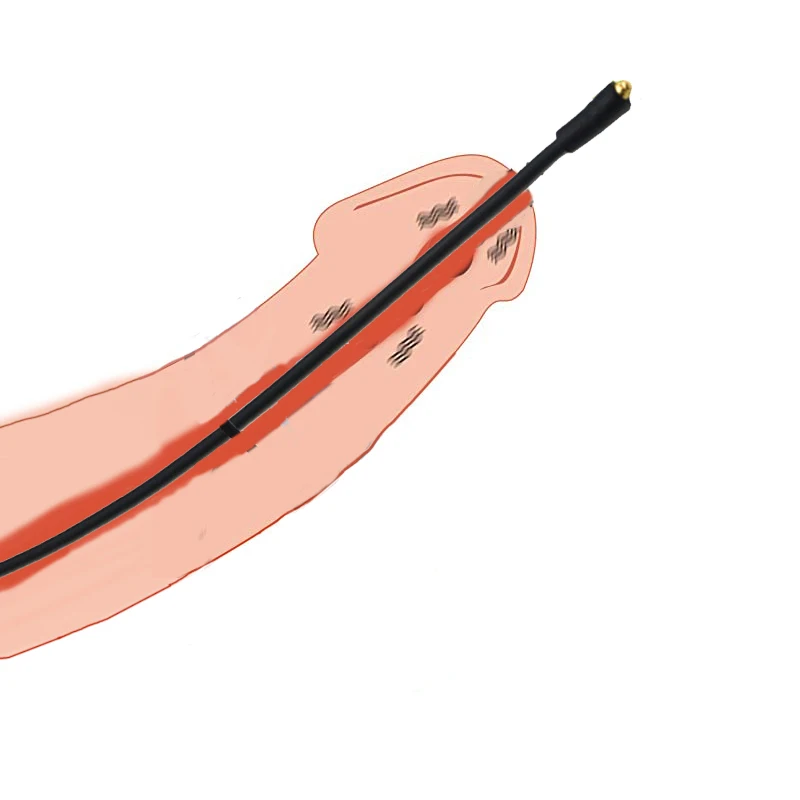 Gigant jinsiy olatni