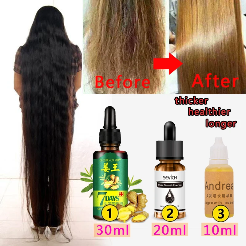 

30/20/10 ML Effective Hair Growth Essence Loss Treatment Scalp Repair Essence Men Women Hair Extension Oil Hair Care Products