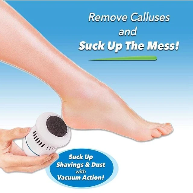 Pedi Vac Callus Remover for Feet with Built-in Vacuum Remove Dead Skin from  Feet 