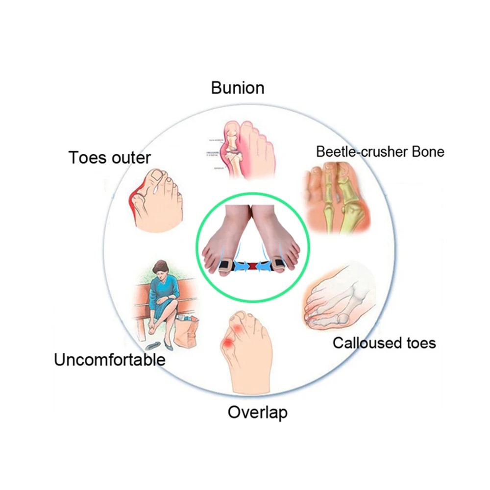 Foot Hallux Valgus Orthotics Big Toe Stretcher Corrector Feet Care Bone Thumb Training massage Splint Correction Z31501
