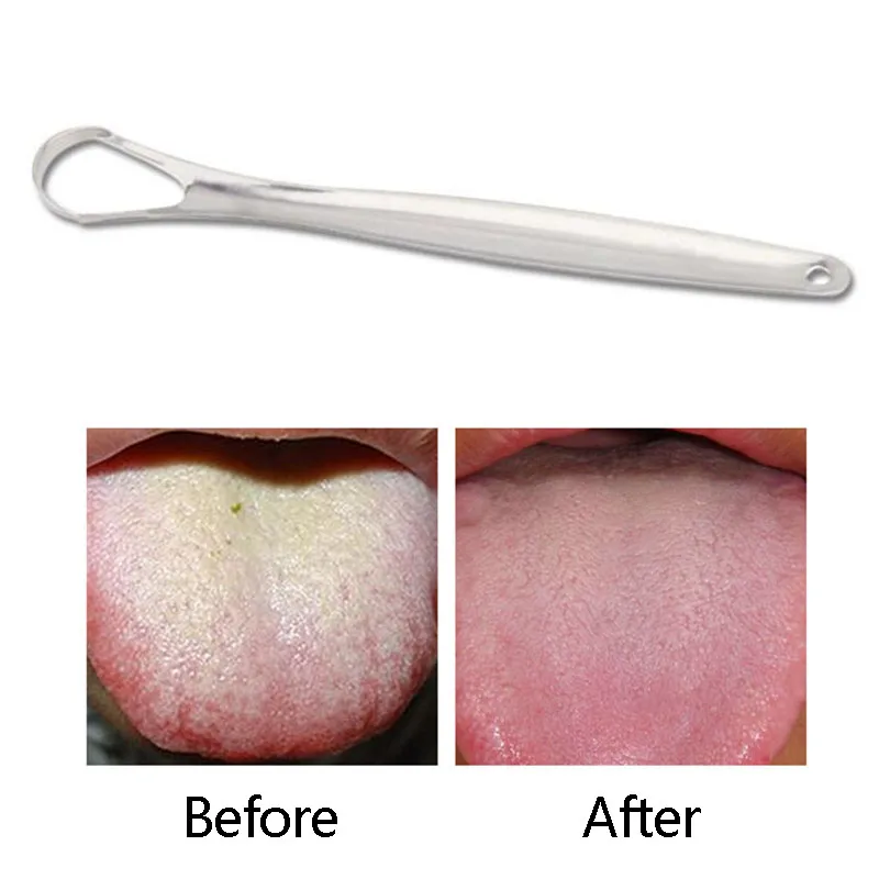 9Z0_1-Pcs-Stainless-Steel-Dental-Oral-Care-Tongue-Oral-Hygiene-Care-Tongue-Cleaner-Scraper-Brush-Light (2)