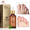 Herbal Nail Fungus Treatment Essence Serum Care Hand and Foot Care Removal Repair Gel Anti-infective Paronychia Onychomycosis ► Photo 3/6