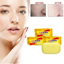Шанхай отбеливания серы растительное мыло Стерилизация и уход за кожей мыло для акне клещей антибактериальное Черное и белое пятно