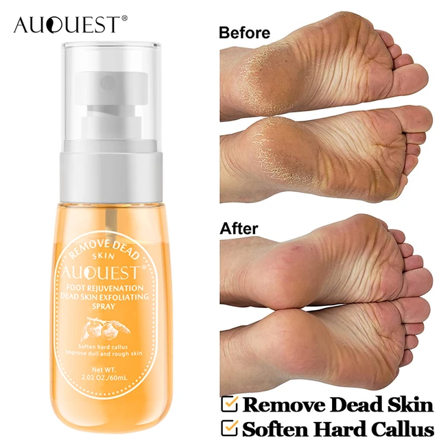 AUQUEST Foot Dead Skin Remover Exfoliator Spray Deodorizers for Shoes Odor  Smell Removal Heel Dry Creak Peeling Foot Skin Care