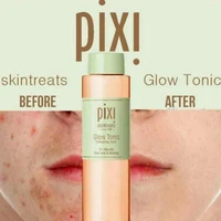 Pixi Skintreats Glow tonico 5% acido glicolico Toner esfoliante idratante viso controllo dell'olio cura della pelle essenza 250ml