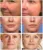 HNKMP Eye Face Massager Electric Vibration Anti-aging Anti-wrinkle Promote Nutrition Puffiness Removal For Eye Fatigue