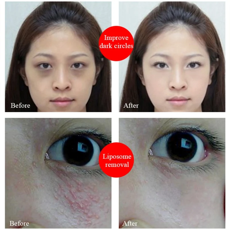 Натуральный нежный Peptide Eye сущность для глаз сумки темные круги тонкие линии подъема и укрепляющий против морщин для кожи вокруг глаз