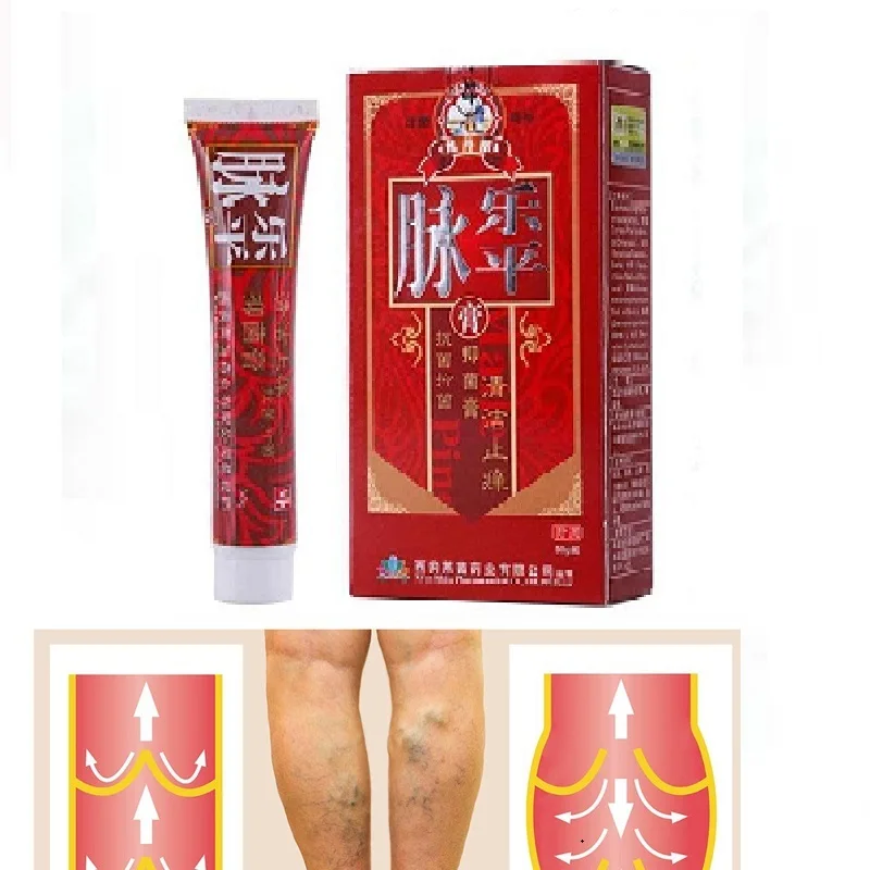

1Pc Varicose Veins Treatment Cream Effective Cure Vasculitis Phlebitis Spider Veins Pain Varicosity Angiitis Ointment