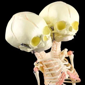 

Human Double Head Baby Skull Research Model Skeleton Anatomical Brain Anatomy 746D