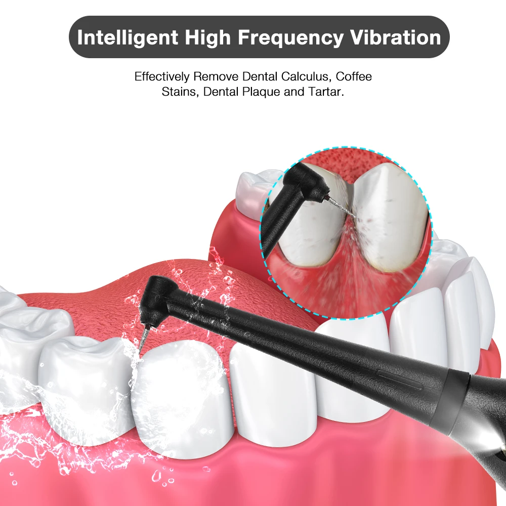 Electric Sonic Dental Calculus Scaler Teeth Whitening Kit Portable with LED Oral Care Teeth Tartar Remover Plaque Stains Cleaner oral irrigator dental cleaner dental scaler