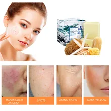 Стойкое к морщинкам Отбеливающее мыло. Устраняет веснушки и акне. Антипруритическое противовоспалительное противогрибковое очищающее мыло ручной работы