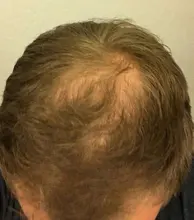 Cuidado del cabello para el crecimiento del cabello aceites esenciales esencia Original auténtico 100% pérdida de cabello líquido salud belleza suero denso para el crecimiento del cabello