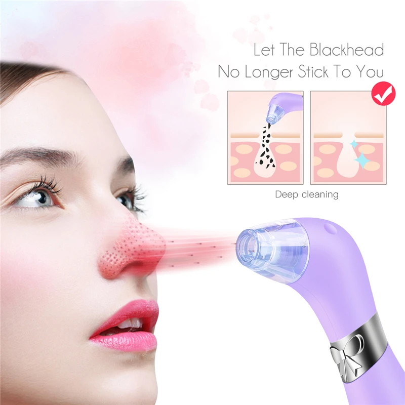 

Electric Blackhead Remover Vacuum Suction Facial Pore Cleaner Deep Cleansing Face Massager Rechargeable Lifting Skin Scrubble