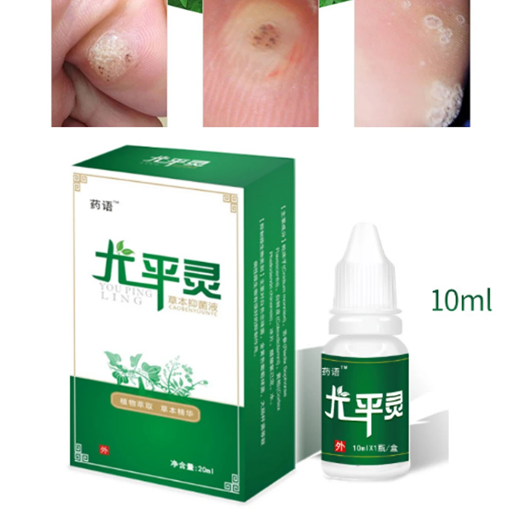 

10ml Skin Tag Remover 12 hours Tu kill Medical Tu kill Remover Skin Tag Mole & Genital Wart Remover Dropshipping D111