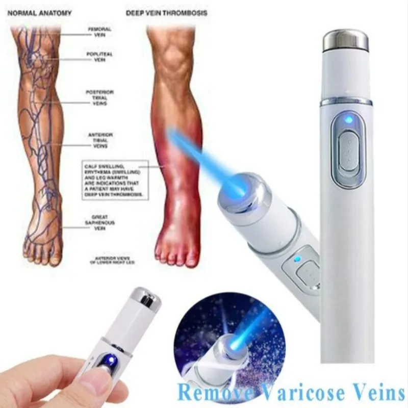 Facial Skin Care Tool Dark Spot Scar Remover Laser Plasma Pen Mole Tattoo Wart Removal Machine 1 Facial Skin Care Tool Dark Spot Scar Remover Laser Plasma Pen Mole Tattoo Wart Removal Machine 5