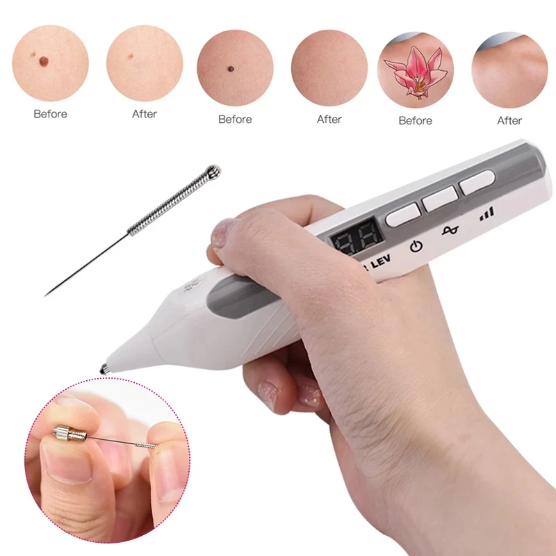 

Eyelid Lift Fibroblast Wrinkle Spot Tattoo Mole Removal Plasma Pen plasmapen for Face Skin Lift