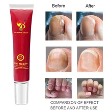 Эффективное лечение грибков для ногтей, жидкая эссенция, против грибка, удаление онихомикоза ногтей, восстанавливающий жидкий уход, макияж 55 г, новинка