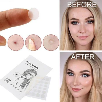 

24/36PCS Facial Acne Patch & Skin Tag Hydrocolloid Pimple Cover Tag Remover Stickers Skin Care Fast newest