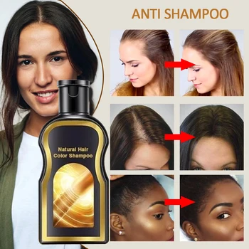 

Natural Anti Hair Loss Liquid Polygonum Multiflorum Hairlos Daily Necessities Herbs 30ml/100ml/200ml Beauty Hair Growth Essence