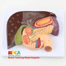 Модель печенки 12 duoцатиперстных желчных камней модель селезенки анатомическая модель обучения медицине Mgz004