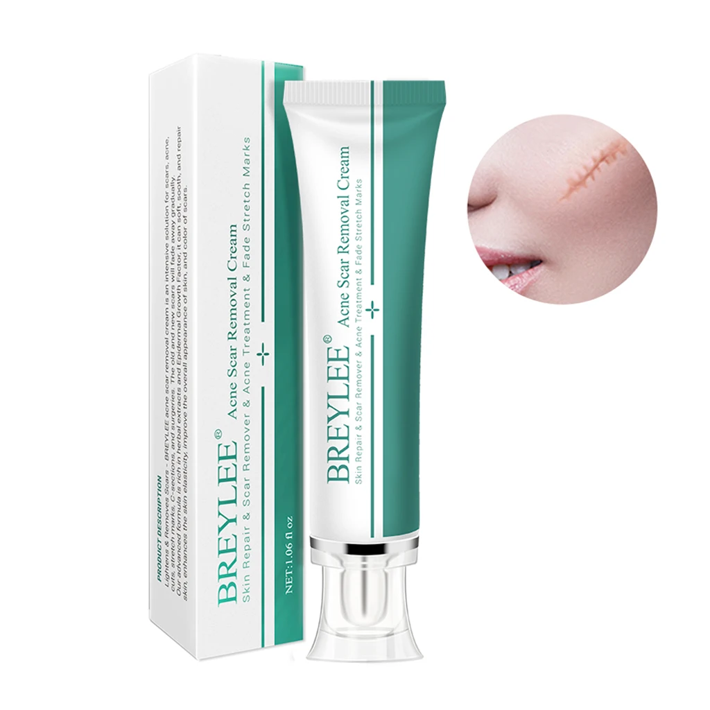 Scar Gel Cream Bruises Stretch Treatment 30g Skin Care Old & New Scars