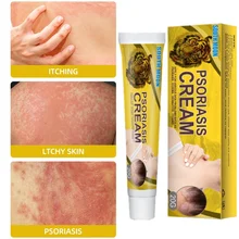 Skin Moss Removal Cream Moss Versicolor Sweat Spot Sweat Spot Itchy Skin Antibacterial Cream Skin Whitening Cream